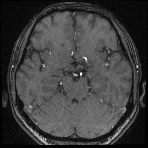 Click on the Serie image to view the images of VILLANUEVA, WILLIAM A.